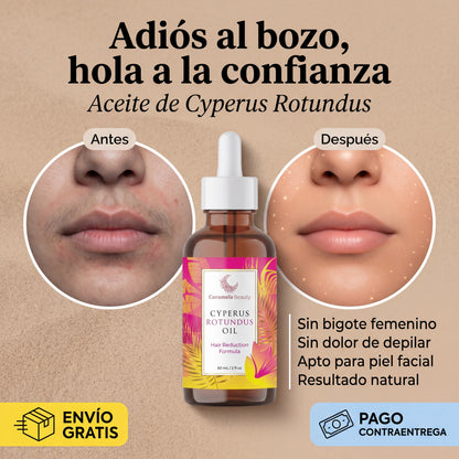 Aceite Cyperus Rotundus® Vello más fino y menos visible
